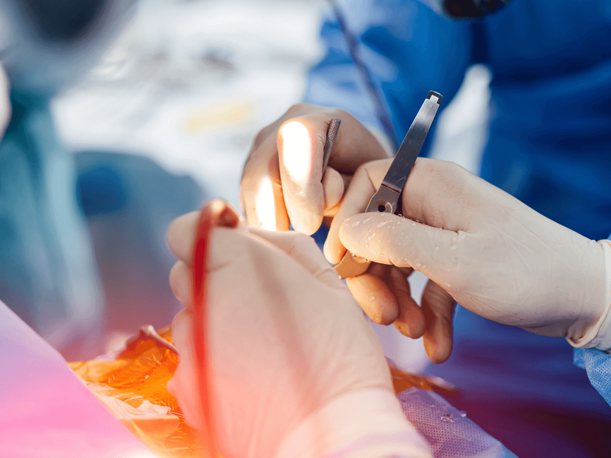 Como a laparoscopia reduz o tempo de recuperação e melhora os resultados pós-cirúrgicos